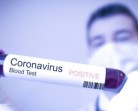Deteksi Virus Corona Dengan Stelop IFSS4 Mass Fever Thermal Imaging